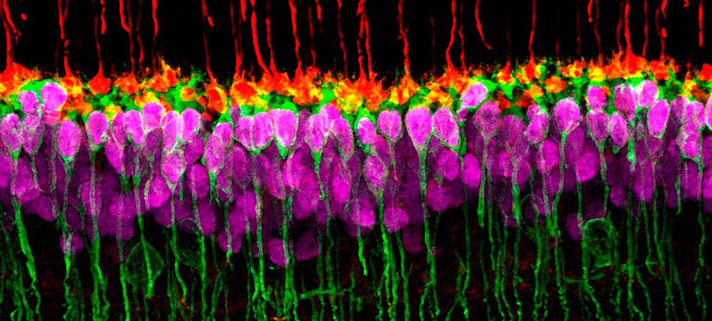 Organoides obtenidos de células madre para reparación de retina