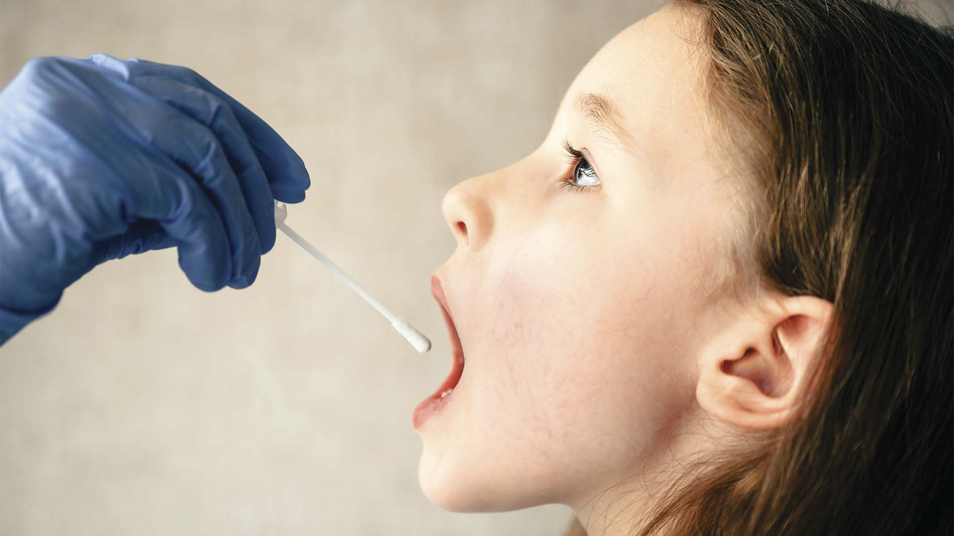 Niña abriendo la boca mientras doctor con guante de latex le realiza prueba con hisopo