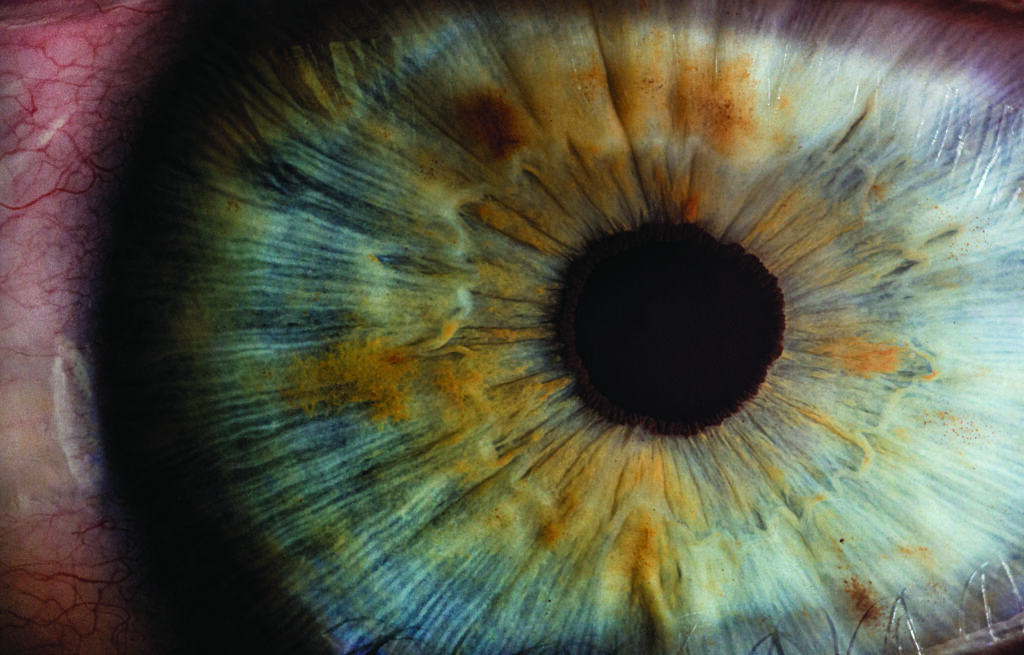 Acercamiento de ojo humano, donde se aprecia a detalle la retina, iris y parte de la esclerótica, en relación a nuevos avances en salud visual
