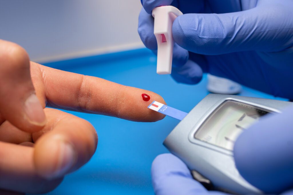 Doctor tomando muestras de glucosa para determinar diabetes